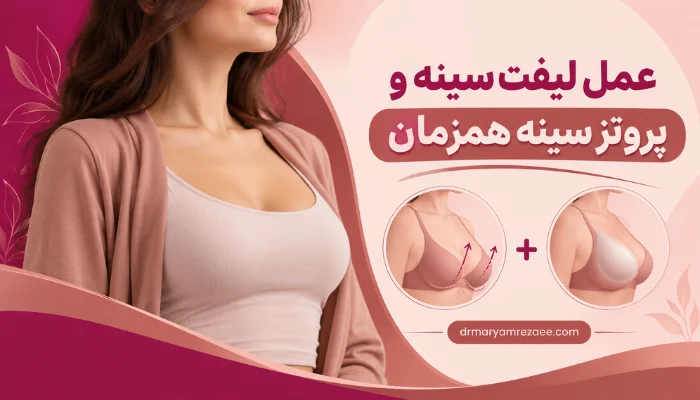لیفت و پروتز سینه همزمان برای اصلاح افتادگی و افزایش حجم سینه با روش پروتز پکسی