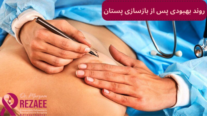 روند بهبودی پس از بازسازی پستان