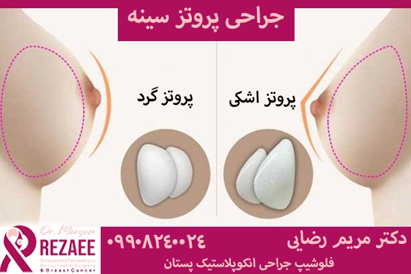 جراحی پروتز سینه
