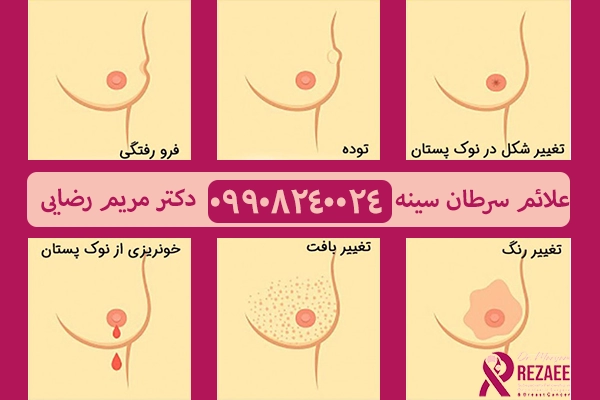 علائم سرطان سینه