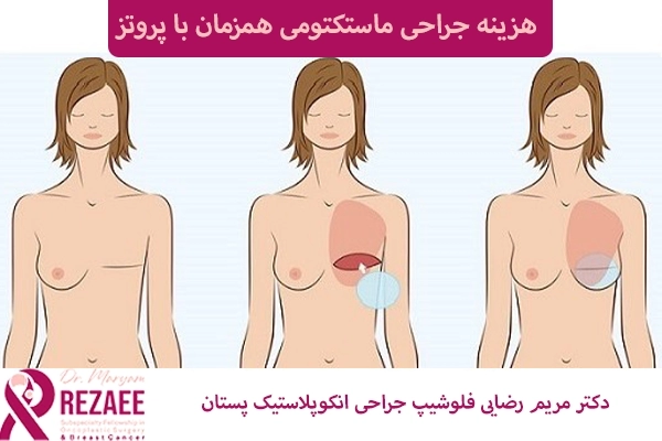 هزینه جراحی پستان