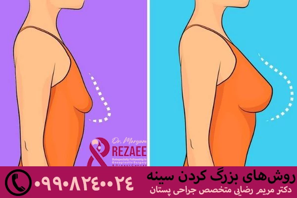 روش های بزرگ کردن سینه
