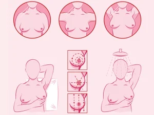 خودآزمایی پستان