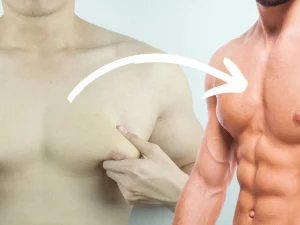 ژنیکوماستی