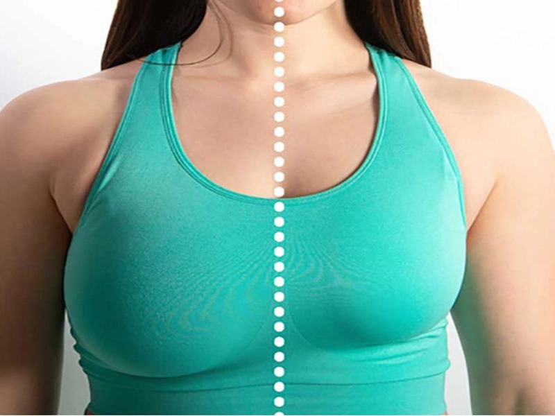 مزایای ماموپلاستی