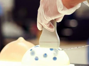 نمونه برداری سینه