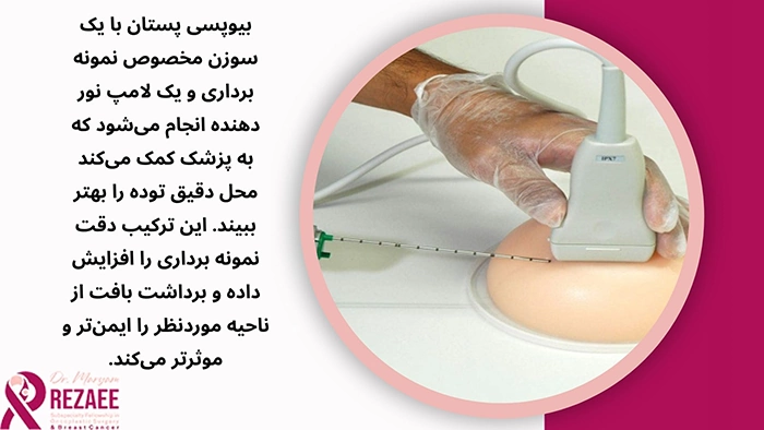 نمونه برداری سینه