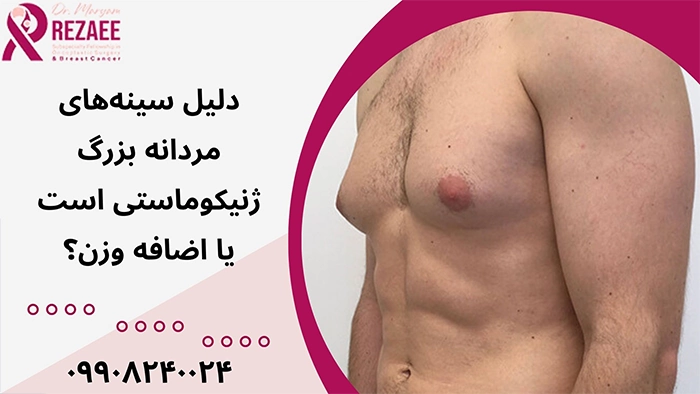 ژنیکوماستی