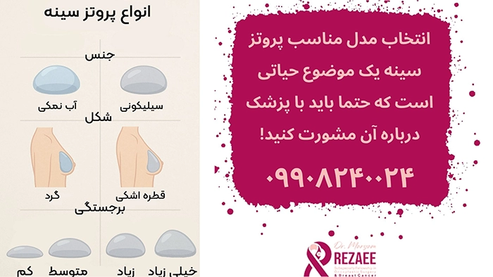 انواع مدل پروتز سینه