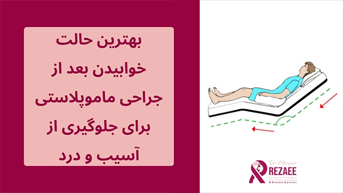 خوابیدن بعد از جراحی ماموپلاستی