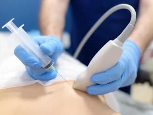 هزینه نمونه برداری سینه