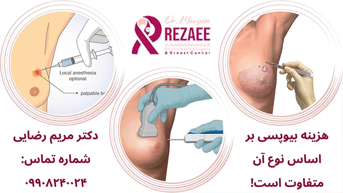 هزینه انواع نمونه برداری سینه