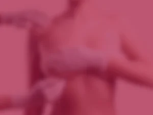 تصویر قبل و بعد پروتز سینه