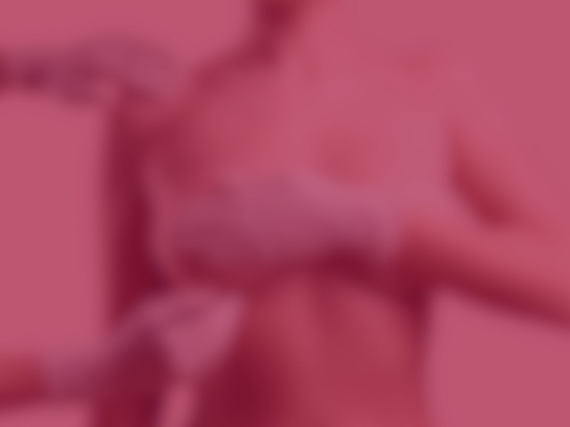 تصویر قبل و بعد پروتز سینه