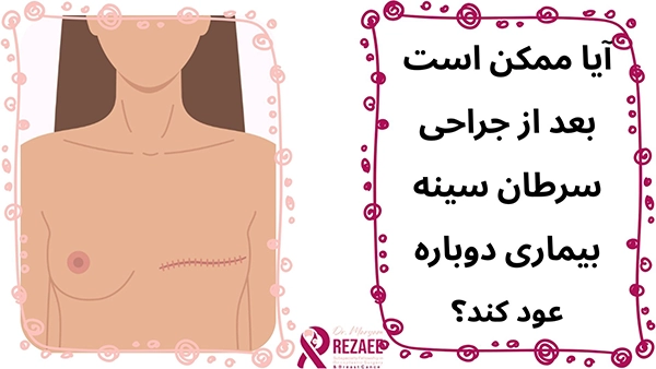 عود بیماری بعد از جراحی سرطان سینه