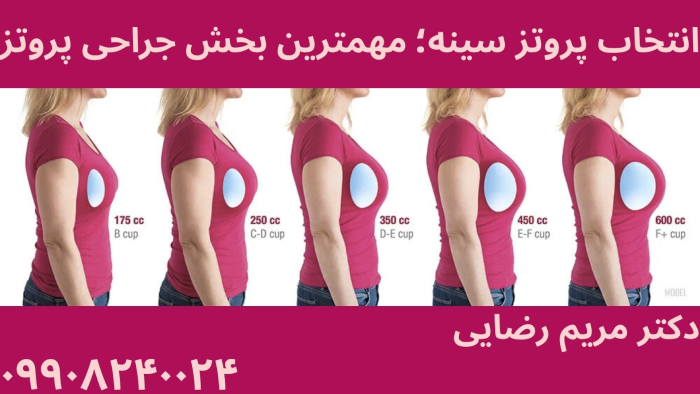سایز پروتز سینه