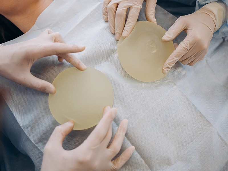 مراقبت‌های بعد از پروتز سینه