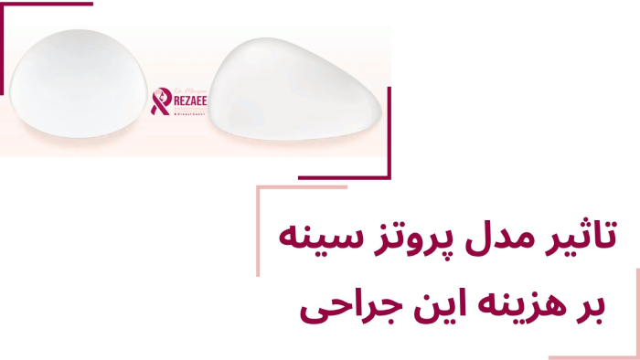 هزینه مدلهای پروتز سینه