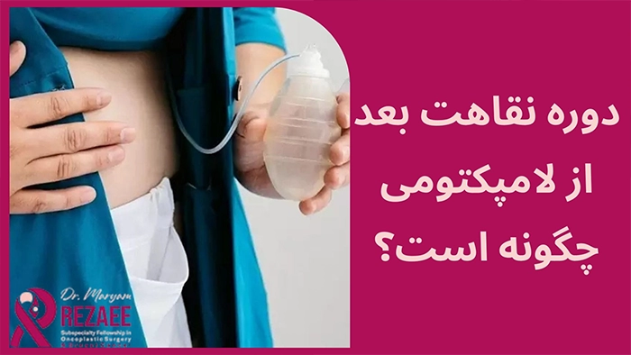 نقاهت بعد از لامپکتومی
