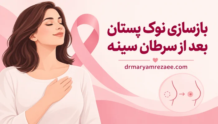 تصویر مفهومی بازسازی نوک پستان بعد از سرطان سینه پس از ماستکتومی و جراحی بازسازی پستان