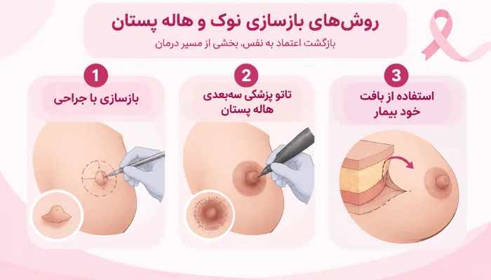 اینفوگرافیک روشهای بازسازی نوک و هاله پستان شامل جراحی، تاتو پزشکی سه بعدی و استفاده از بافت خود بیمار