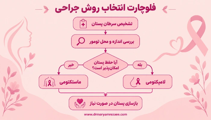 فلوچارت انتخاب روش جراحی سرطان پستان بین لامپکتومی و ماستکتومی