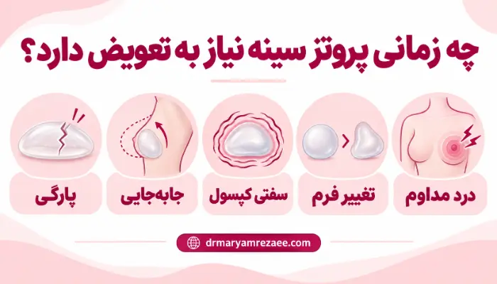 نشانه های نیاز به تعویض پروتز سینه شامل پارگی جابه جایی سفتی کپسول تغییر فرم و درد